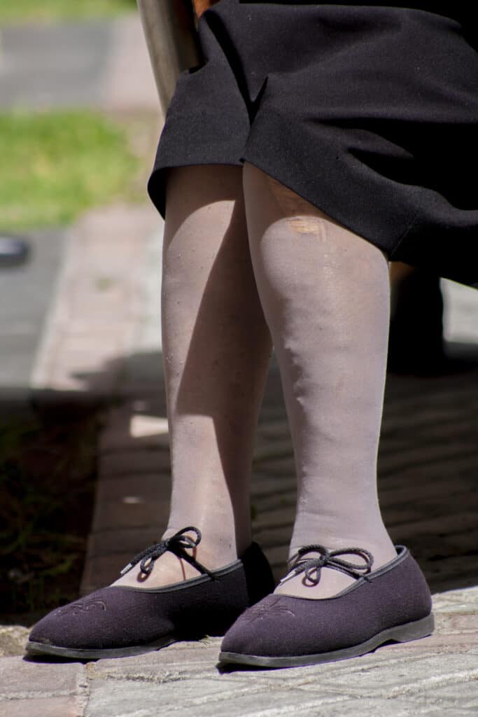 are varicose veins dangerous