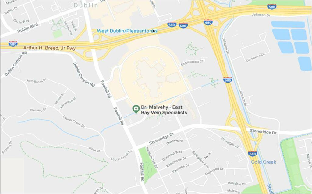 best varicose vein bay area